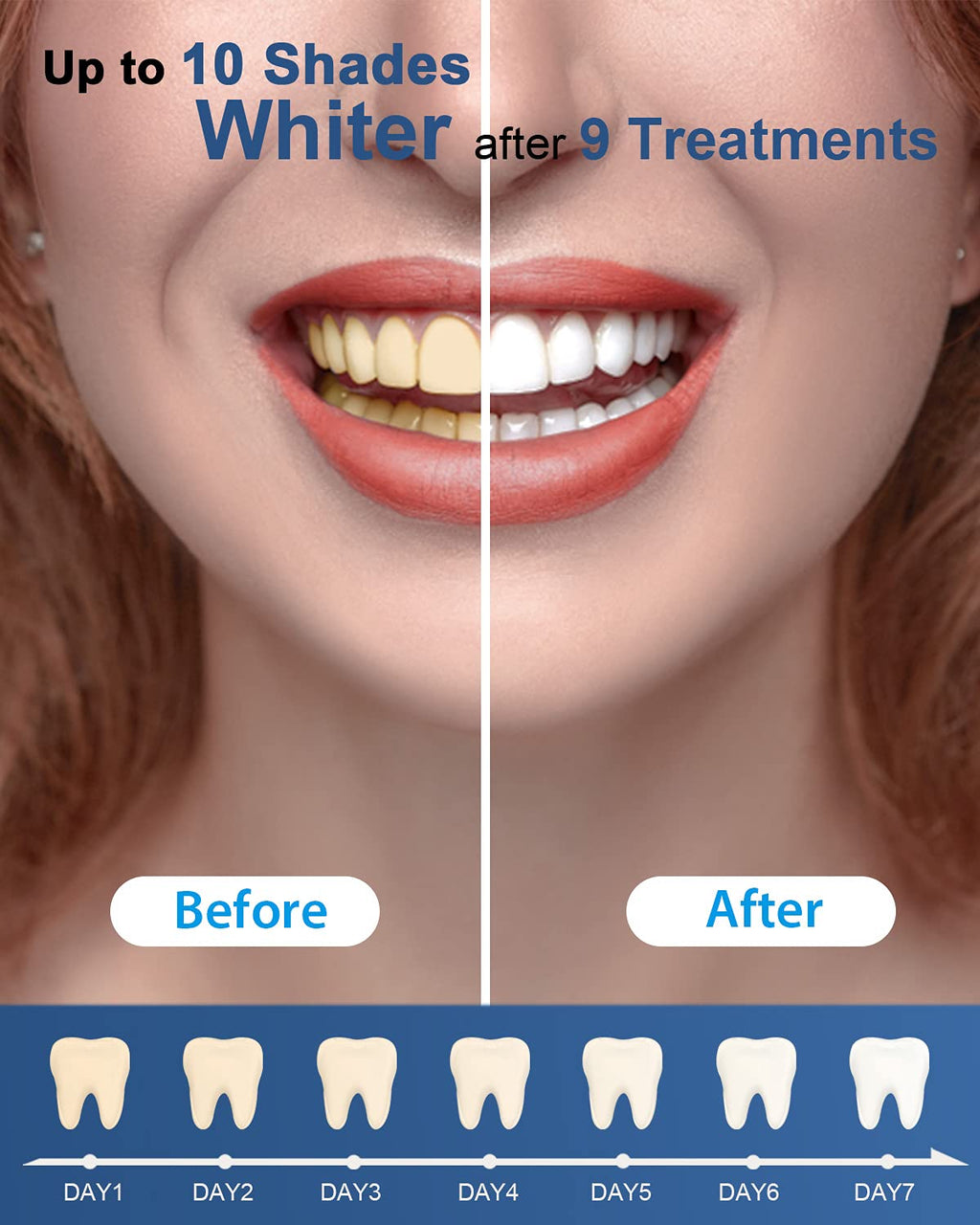 MySmile Teeth Whitening Gel Refills Pack 30+ Treatment Non-Sensitive Enamel Safe Tooth Whitener -10 Min Fast Whitening Teeth - Helps to Remove Stains from Coffee, Smoking, Wines（Excluding Tray Light）