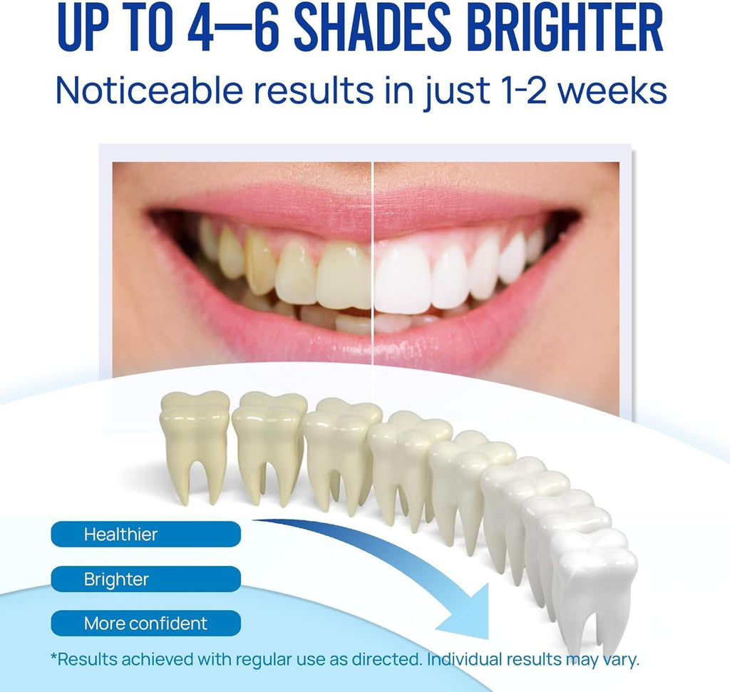 VieBeauti Teeth Whitening Pen Gel: 30+ Uses - Teeth whitening Gel with Professional Formulation and Ingredients, No Sensitivity, Travel-Friendly, Beautiful White Smile Mint