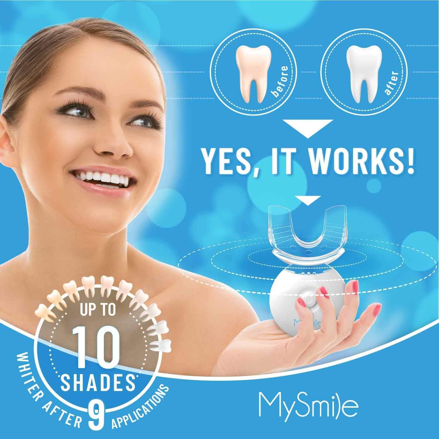 MySmile Teeth Whitening Gel Refills Pack 30+ Treatment Non-Sensitive Enamel Safe Tooth Whitener -10 Min Fast Whitening Teeth - Helps to Remove Stains from Coffee, Smoking, Wines（Excluding Tray Light）