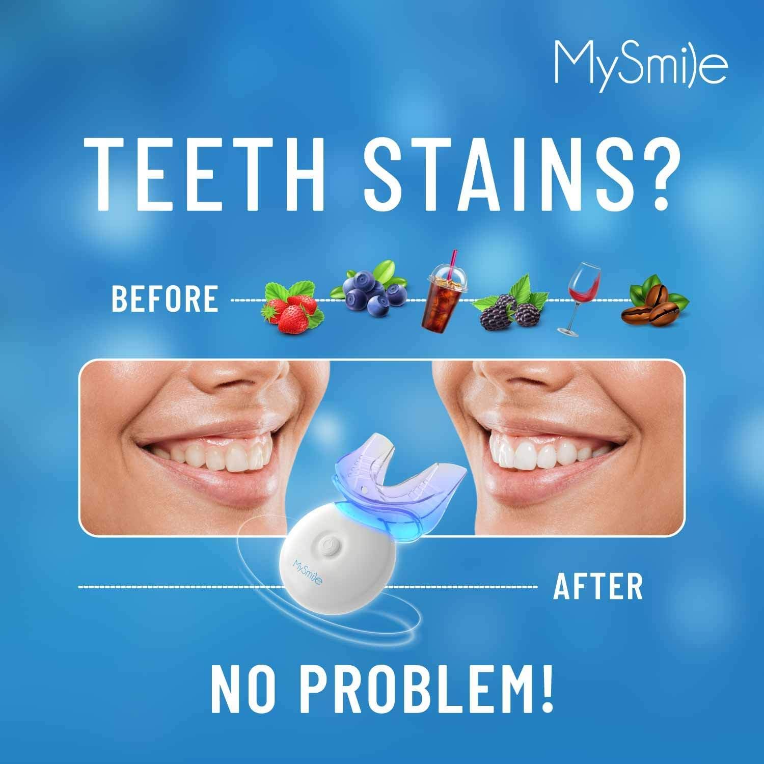 MySmile Teeth Whitening Gel Refills Pack 30+ Treatment Non-Sensitive Enamel Safe Tooth Whitener -10 Min Fast Whitening Teeth - Helps to Remove Stains from Coffee, Smoking, Wines（Excluding Tray Light）