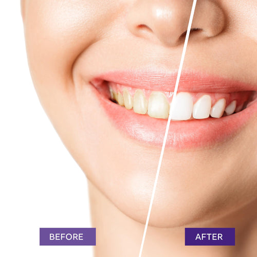 Teeth Whitening Purple Toothpaste - Tooth Whitener Gel 30ml