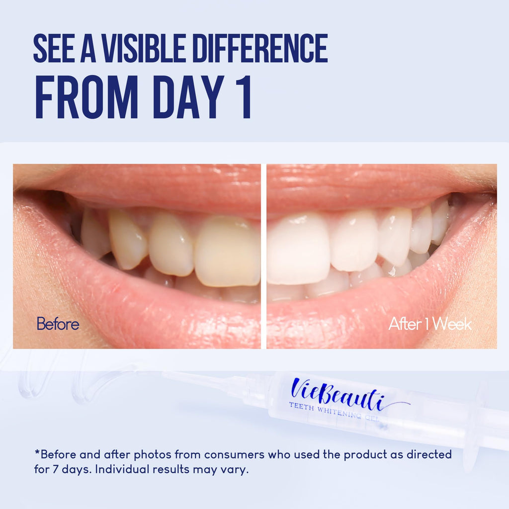 VieBeauti Teeth Whitening Pen Gel: 30+ Uses - Teeth whitening Gel with Professional Formulation and Ingredients, No Sensitivity, Travel-Friendly, Beautiful White Smile Mint