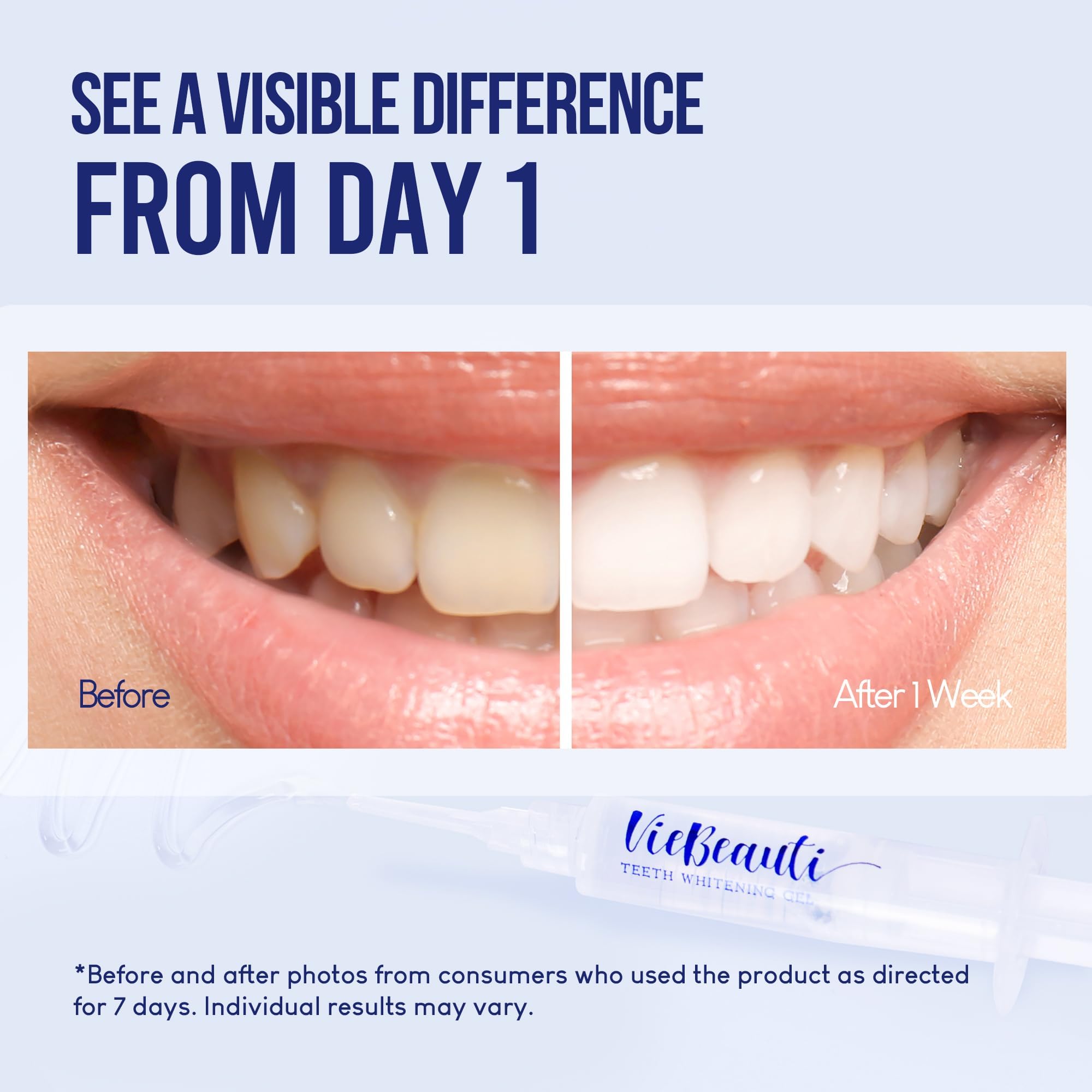 VieBeauti Teeth Whitening Pen Gel: 30+ Uses - Teeth whitening Gel with Professional Formulation and Ingredients, No Sensitivity, Travel-Friendly, Beautiful White Smile Mint
