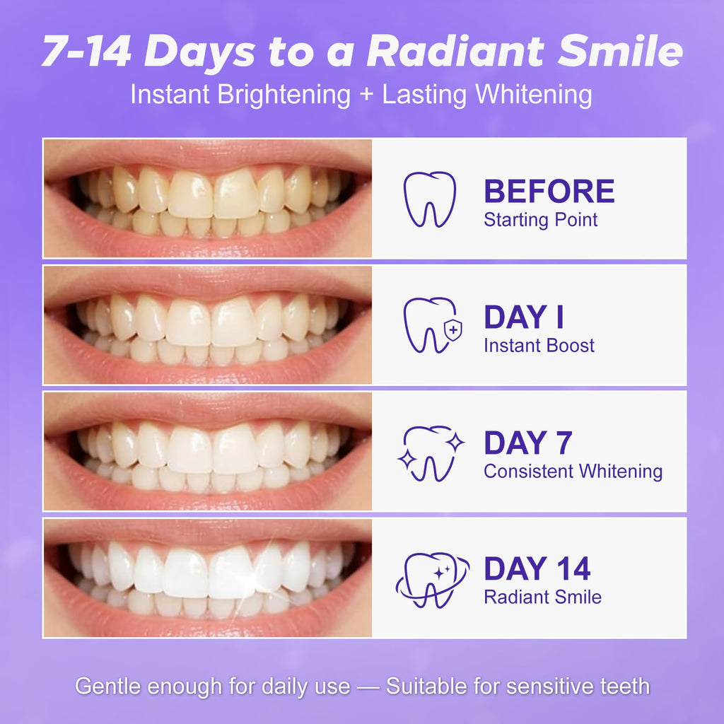Purple Teeth Whitening Strip 20 Non-Slip Strips - Whitening for Teeth Sensitive, Professional Teeth Whitening Strips, Fast Remove Smoking, Coffee, Wine Stains, Teeth Whitening Kit Pack