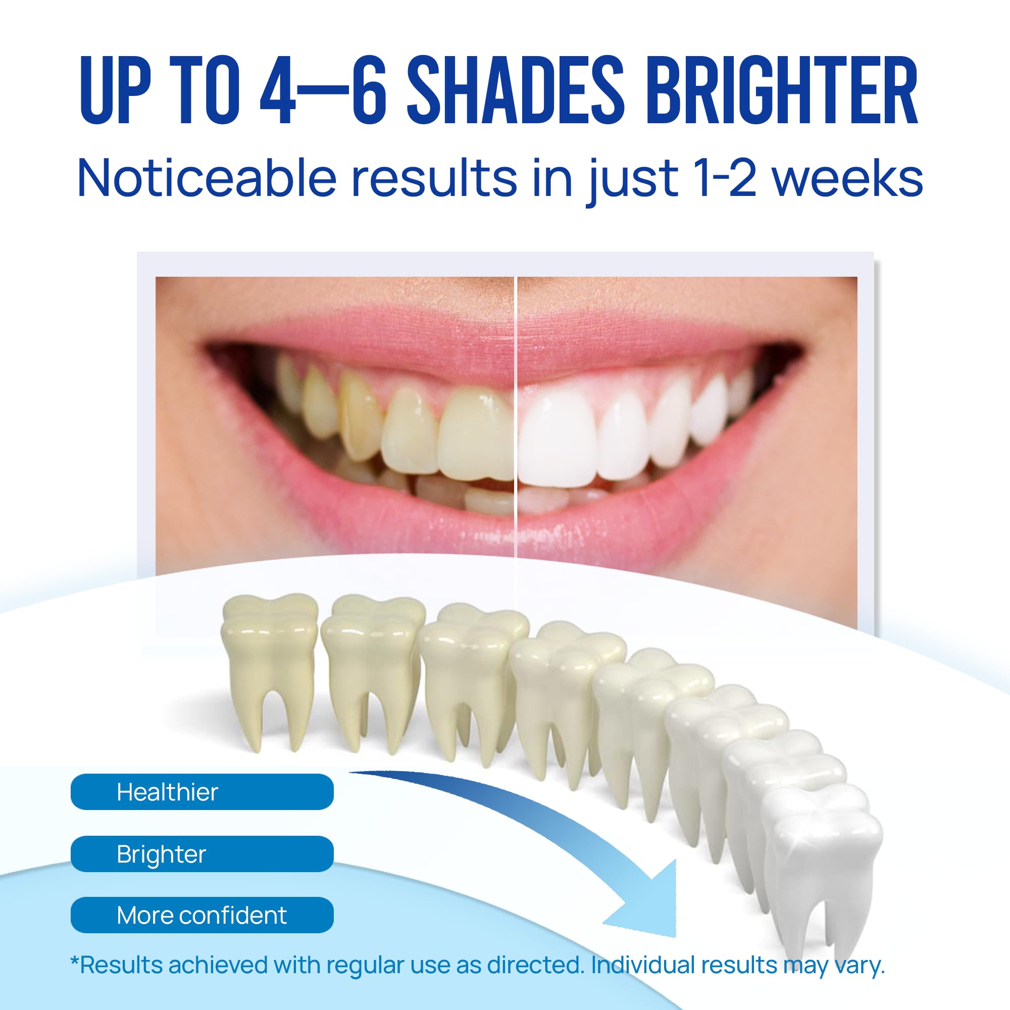 VieBeauti Teeth Whitening Pen Gel: 30+ Uses - Teeth whitening Gel with Professional Formulation and Ingredients, No Sensitivity, Travel-Friendly, Beautiful White Smile Mint